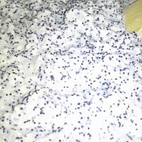 Placki ziemniaczane z makiem