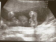 Fot. nika1979, Iwo będzie miał rodzeństwo:)